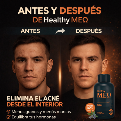 REGULADOR HORMONAL MASCULINO ANTIACNE