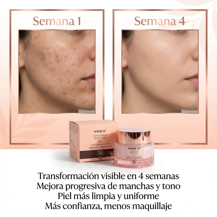 ToneClear S10 - Crema Facial Aclaradora de Manchas Profundas