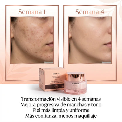 ToneClear S10 - Crema Facial Aclaradora de Manchas Profundas